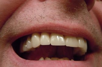 зубы-стоматологический-зуб-рот