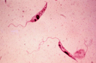 Лейшманиоз