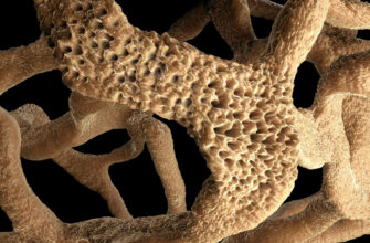 Остеопороз