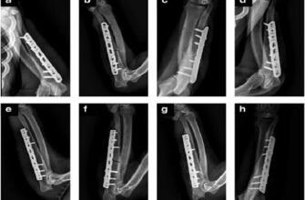 Каркас из стекла